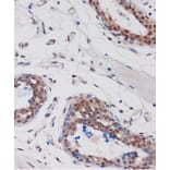 Immunohistochemistry - Anti-ARID1B Antibody (A92400) - Antibodies.com