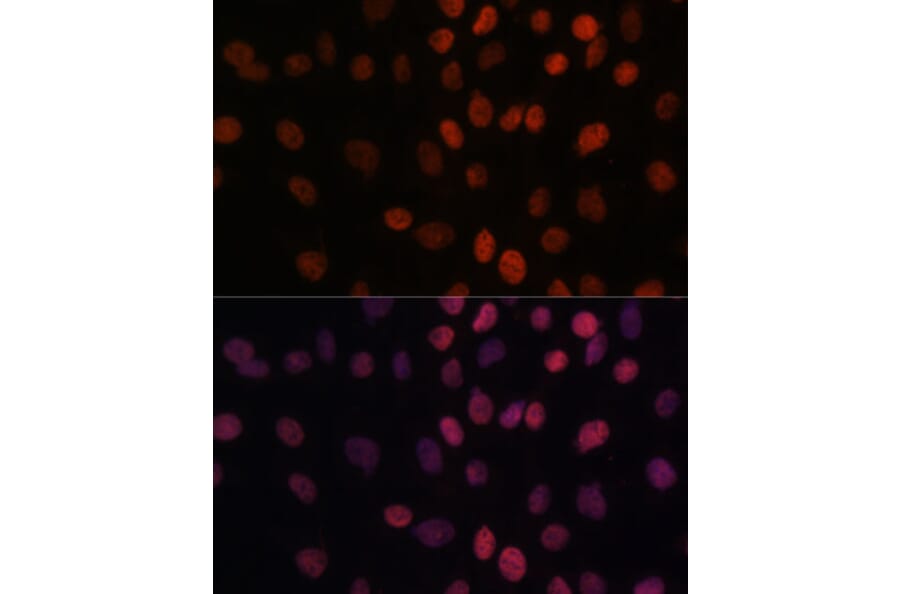 Immunofluorescence - Anti-ARID1B Antibody (A92400) - Antibodies.com