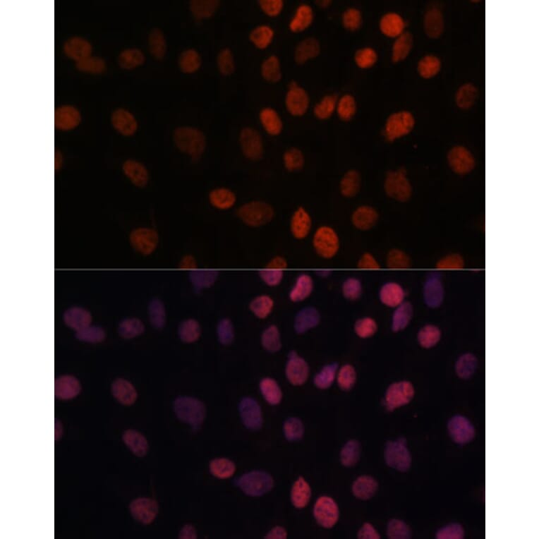 Immunofluorescence - Anti-ARID1B Antibody (A92400) - Antibodies.com