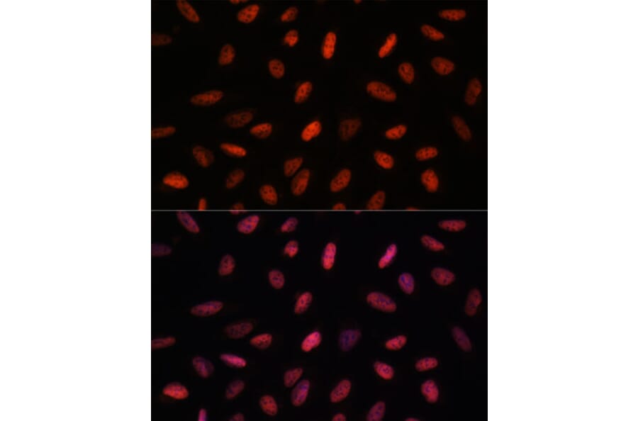 Immunofluorescence - Anti-ARID1B Antibody (A92400) - Antibodies.com