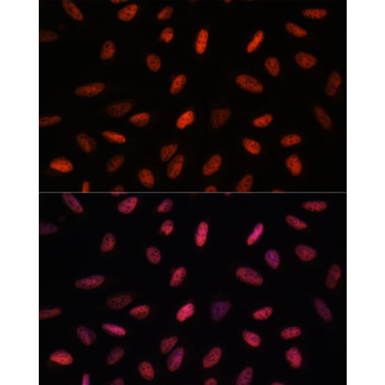 Immunofluorescence - Anti-ARID1B Antibody (A92400) - Antibodies.com