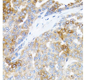 Immunohistochemistry - Anti-STAT3 Antibody (A92403) - Antibodies.com