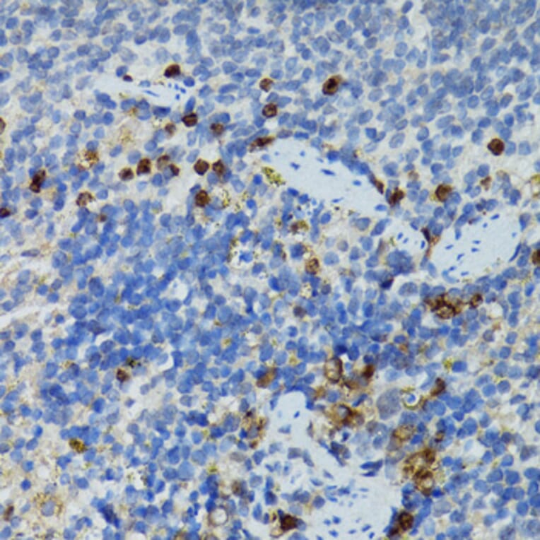 Immunohistochemistry - Anti-STAT3 Antibody (A92403) - Antibodies.com