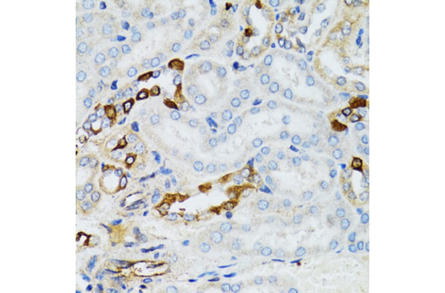 Immunohistochemistry - Anti-STAT3 Antibody (A92403) - Antibodies.com