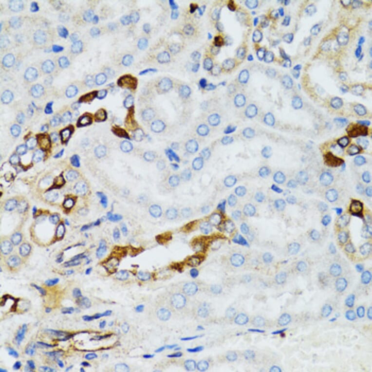 Immunohistochemistry - Anti-STAT3 Antibody (A92403) - Antibodies.com