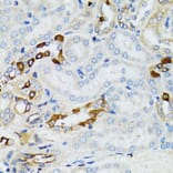 Immunohistochemistry - Anti-STAT3 Antibody (A92403) - Antibodies.com