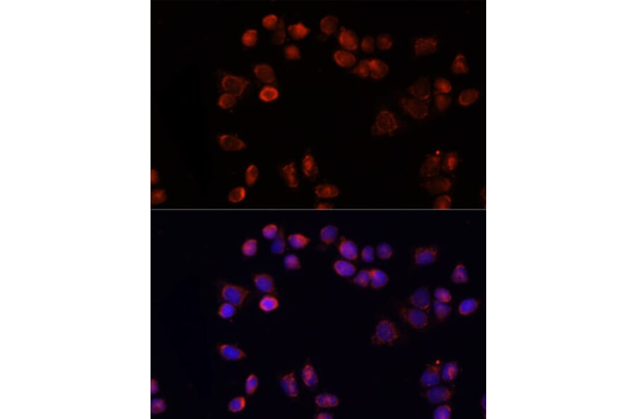 Immunofluorescence - Anti-Adenine Nucleotide Translocator 1/ANT 1 Antibody (A92404) - Antibodies.com