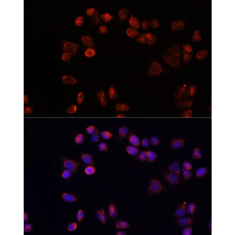Immunofluorescence - Anti-Adenine Nucleotide Translocator 1/ANT 1 Antibody (A92404) - Antibodies.com