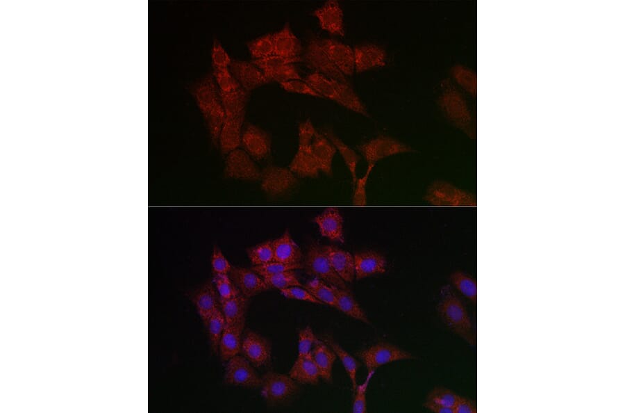 Immunofluorescence - Anti-Adenine Nucleotide Translocator 1/ANT 1 Antibody (A92404) - Antibodies.com
