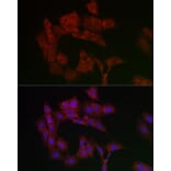 Immunofluorescence - Anti-Adenine Nucleotide Translocator 1/ANT 1 Antibody (A92404) - Antibodies.com