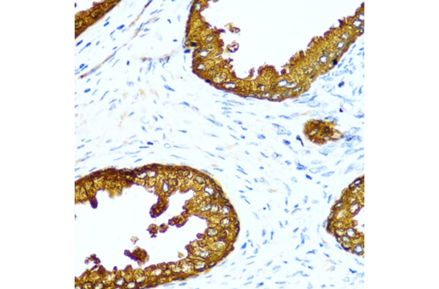 Immunohistochemistry - Anti-ACPP Antibody (A13457) - Antibodies.com