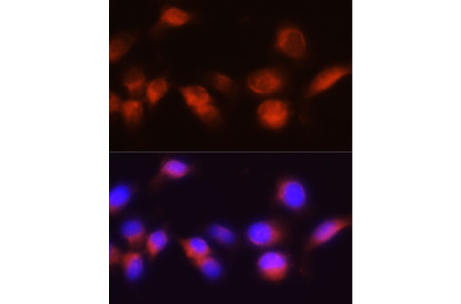 Immunofluorescence - Anti-ACPP Antibody (A13457) - Antibodies.com