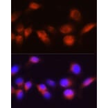 Immunofluorescence - Anti-ACPP Antibody (A13457) - Antibodies.com