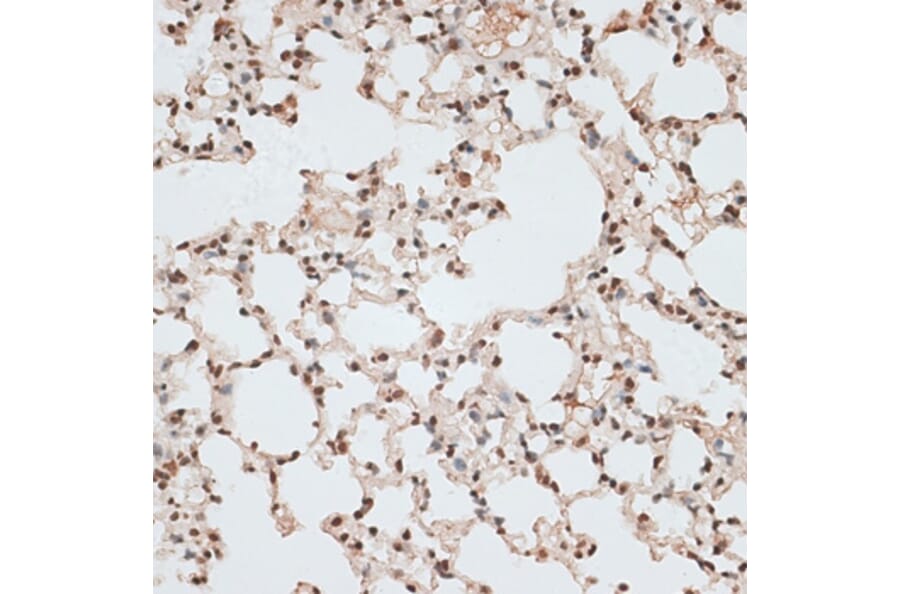 Immunohistochemistry - Anti-ZNF141 Antibody (A92406) - Antibodies.com