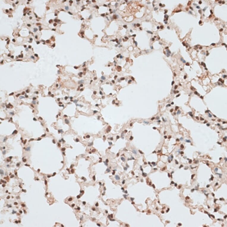 Immunohistochemistry - Anti-ZNF141 Antibody (A92406) - Antibodies.com