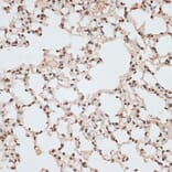 Immunohistochemistry - Anti-ZNF141 Antibody (A92406) - Antibodies.com