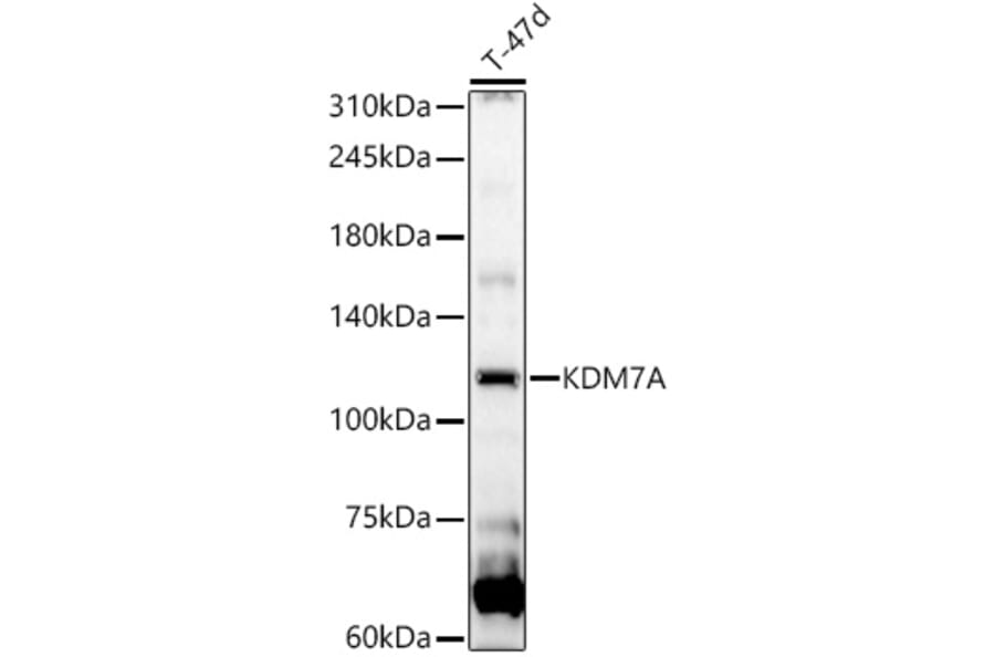 Western Blot - Anti-JHDM1D Antibody (A92411) - Antibodies.com