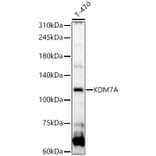 Western Blot - Anti-JHDM1D Antibody (A92411) - Antibodies.com