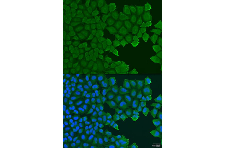 Immunofluorescence - Anti-TCTN2 Antibody (A15191) - Antibodies.com