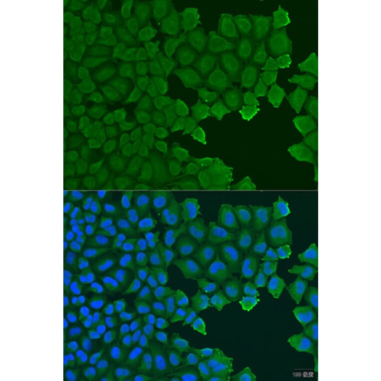 Immunofluorescence - Anti-TCTN2 Antibody (A15191) - Antibodies.com