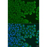 Immunofluorescence - Anti-TCTN2 Antibody (A15191) - Antibodies.com