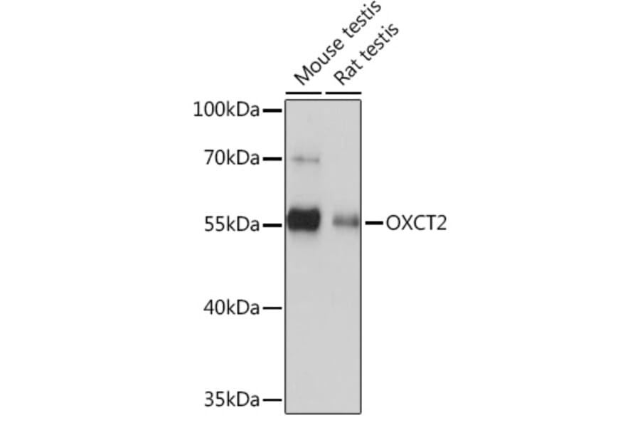 Western Blot - Anti-OXCT2 Antibody (A92415) - Antibodies.com