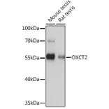Western Blot - Anti-OXCT2 Antibody (A92415) - Antibodies.com