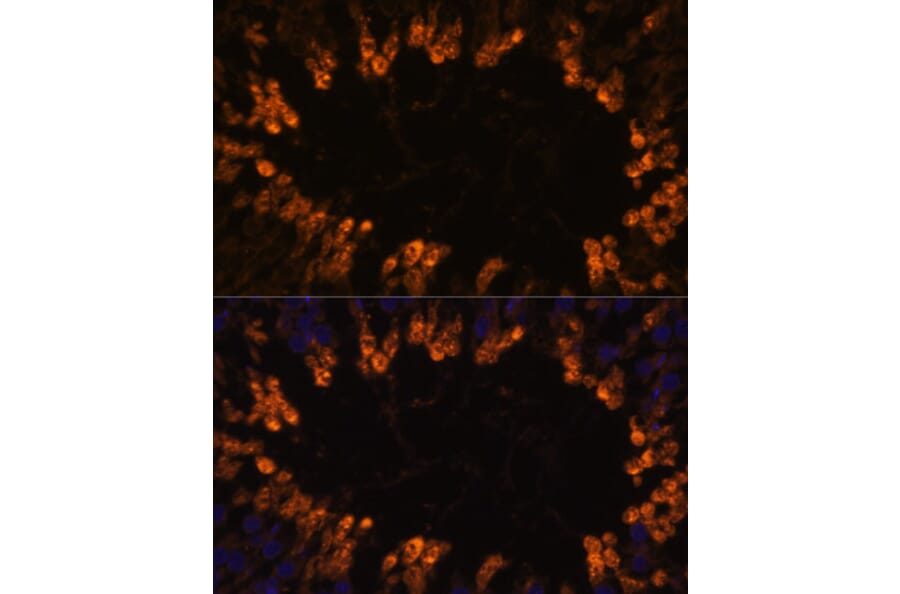 Immunofluorescence - Anti-OXCT2 Antibody (A92415) - Antibodies.com