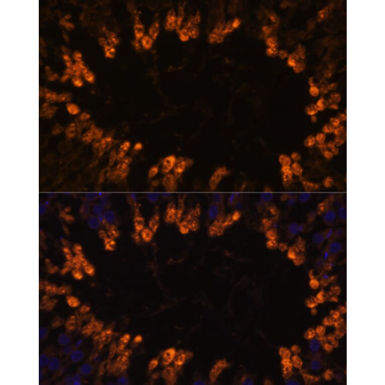 Immunofluorescence - Anti-OXCT2 Antibody (A92415) - Antibodies.com