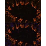 Immunofluorescence - Anti-OXCT2 Antibody (A92415) - Antibodies.com