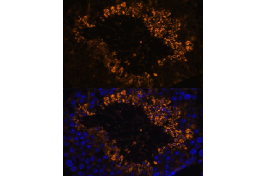 Immunofluorescence - Anti-OXCT2 Antibody (A92415) - Antibodies.com