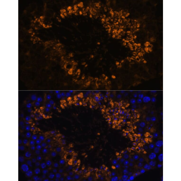Immunofluorescence - Anti-OXCT2 Antibody (A92415) - Antibodies.com