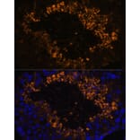 Immunofluorescence - Anti-OXCT2 Antibody (A92415) - Antibodies.com