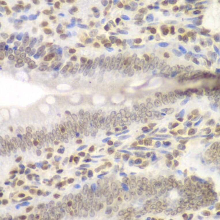 Immunohistochemistry - Anti-NIRF Antibody (A92417) - Antibodies.com