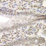 Immunohistochemistry - Anti-NIRF Antibody (A92417) - Antibodies.com