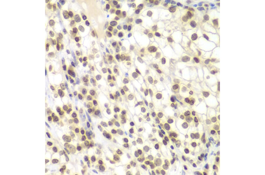 Immunohistochemistry - Anti-NIRF Antibody (A92417) - Antibodies.com