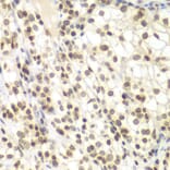 Immunohistochemistry - Anti-NIRF Antibody (A92417) - Antibodies.com