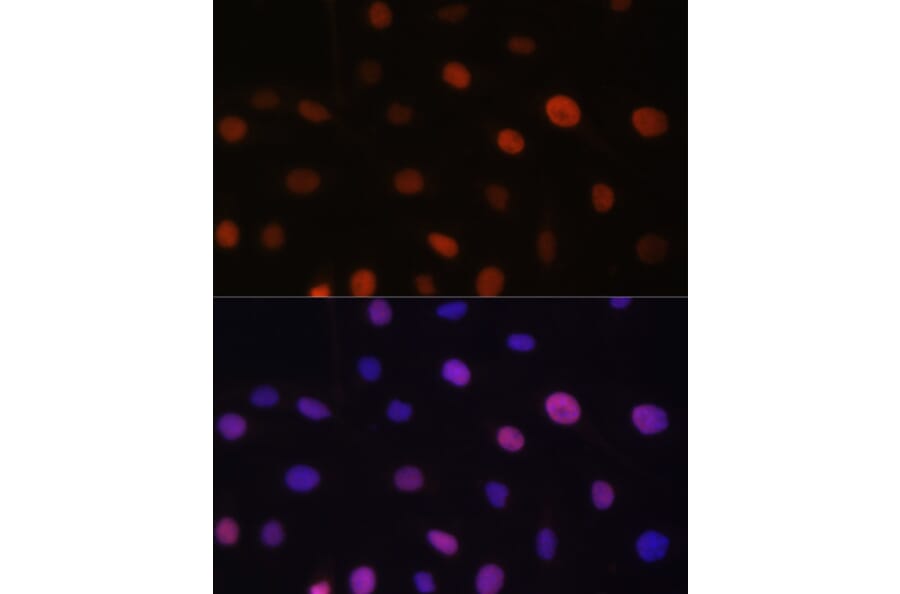 Immunofluorescence - Anti-NIRF Antibody (A92417) - Antibodies.com