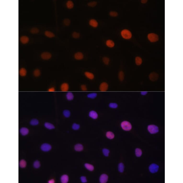 Immunofluorescence - Anti-NIRF Antibody (A92417) - Antibodies.com