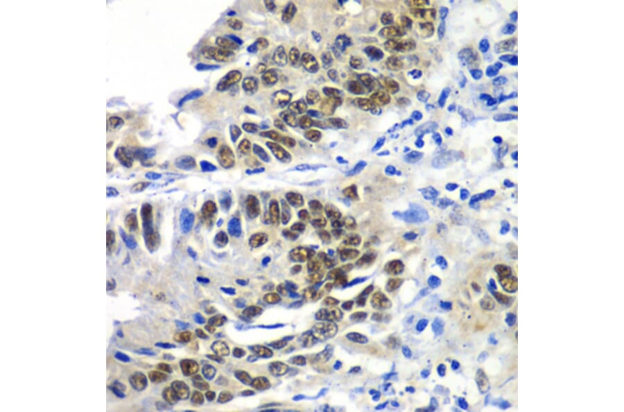 Immunohistochemistry - Anti-DACH1 Antibody (A3823) - Antibodies.com