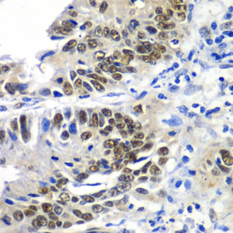 Immunohistochemistry - Anti-DACH1 Antibody (A3823) - Antibodies.com
