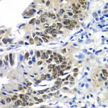 Immunohistochemistry - Anti-DACH1 Antibody (A3823) - Antibodies.com
