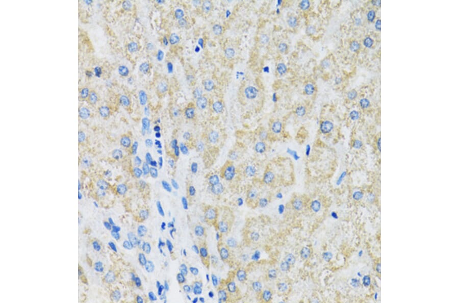 Immunohistochemistry - Anti-SLC19A1 Antibody (A14644) - Antibodies.com