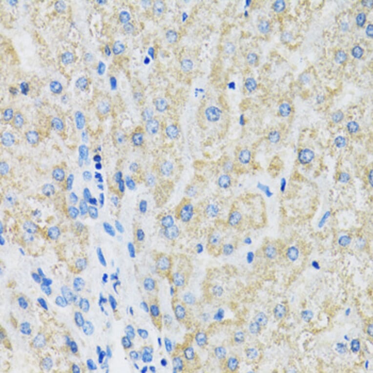 Immunohistochemistry - Anti-SLC19A1 Antibody (A14644) - Antibodies.com