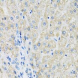 Immunohistochemistry - Anti-SLC19A1 Antibody (A14644) - Antibodies.com