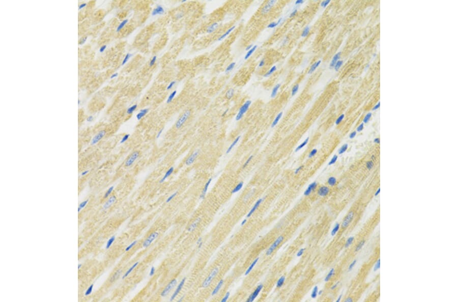 Immunohistochemistry - Anti-SLC19A1 Antibody (A14644) - Antibodies.com