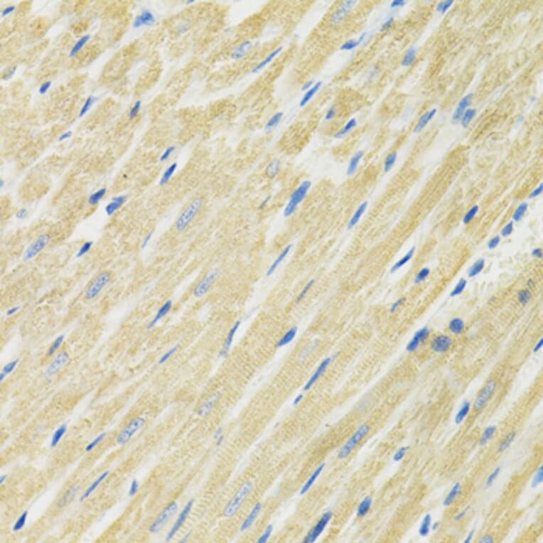Immunohistochemistry - Anti-SLC19A1 Antibody (A14644) - Antibodies.com