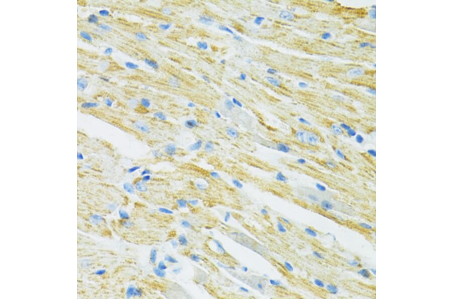 Immunohistochemistry - Anti-SLC19A1 Antibody (A14644) - Antibodies.com