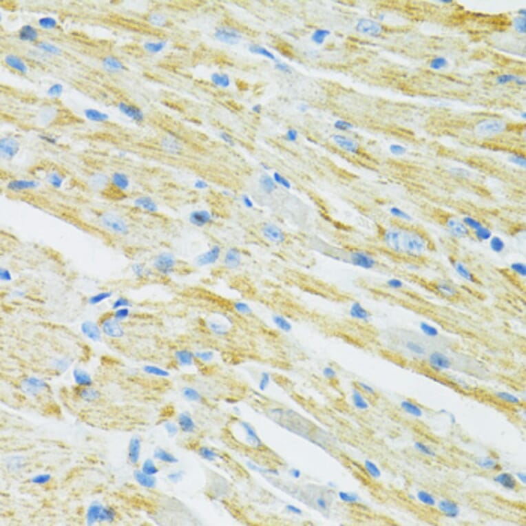 Immunohistochemistry - Anti-SLC19A1 Antibody (A14644) - Antibodies.com