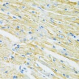 Immunohistochemistry - Anti-SLC19A1 Antibody (A14644) - Antibodies.com